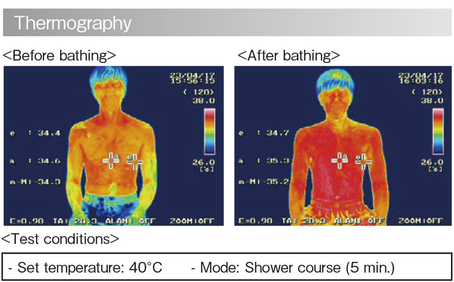 Thermography