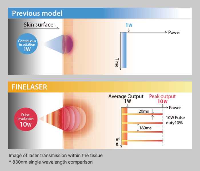 FINELASER comparison of continuous and pulsed laser therapy
