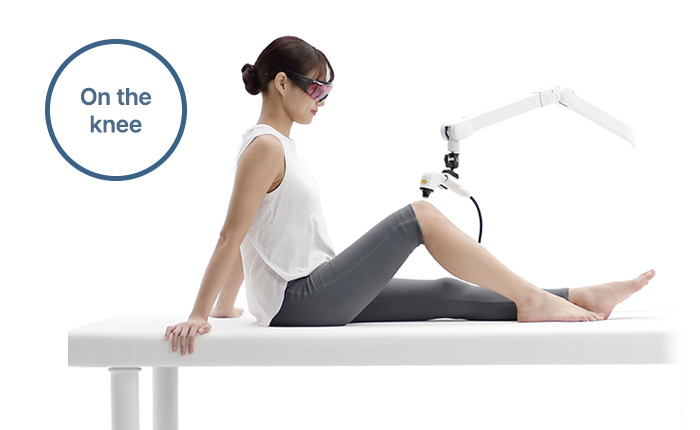 FINELASER arm positioning on the knee