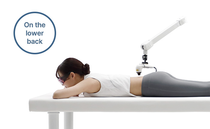 FINELASER arm positioning on the lower back
