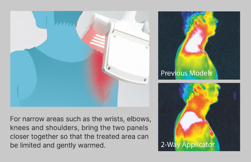MICRO THERMY applicator treatment example