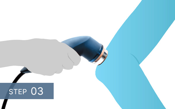 PHYSISONIC ES-7 step 3 treatment start